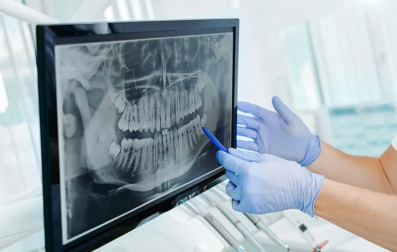 dental-xrays